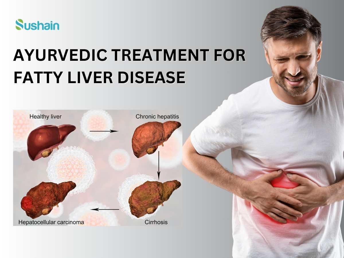  Best Ayurvedic Medicine for fatty liver