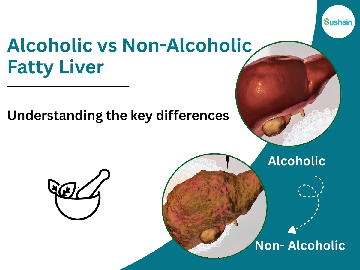 Alcoholic vs Non-Alcoholic Fatty Liver Disease: Causes, Symptoms & Cure